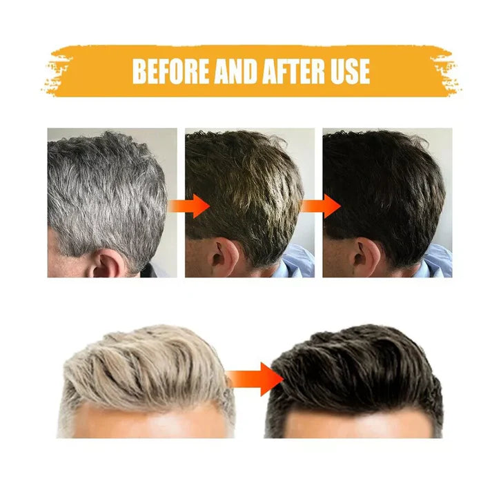 JABON ANTICANAS BLACK SOAP® ORIGINAL 🚨 OFERTA 2X1 🚨