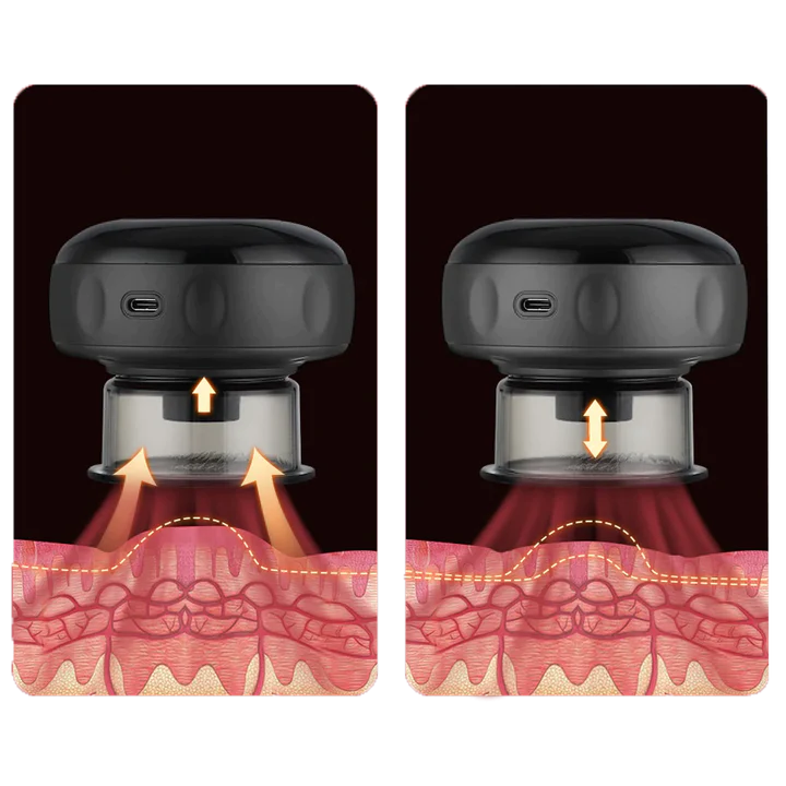 VentPro™ Masajeador Eléctrico Con Terapia De Luz Roja