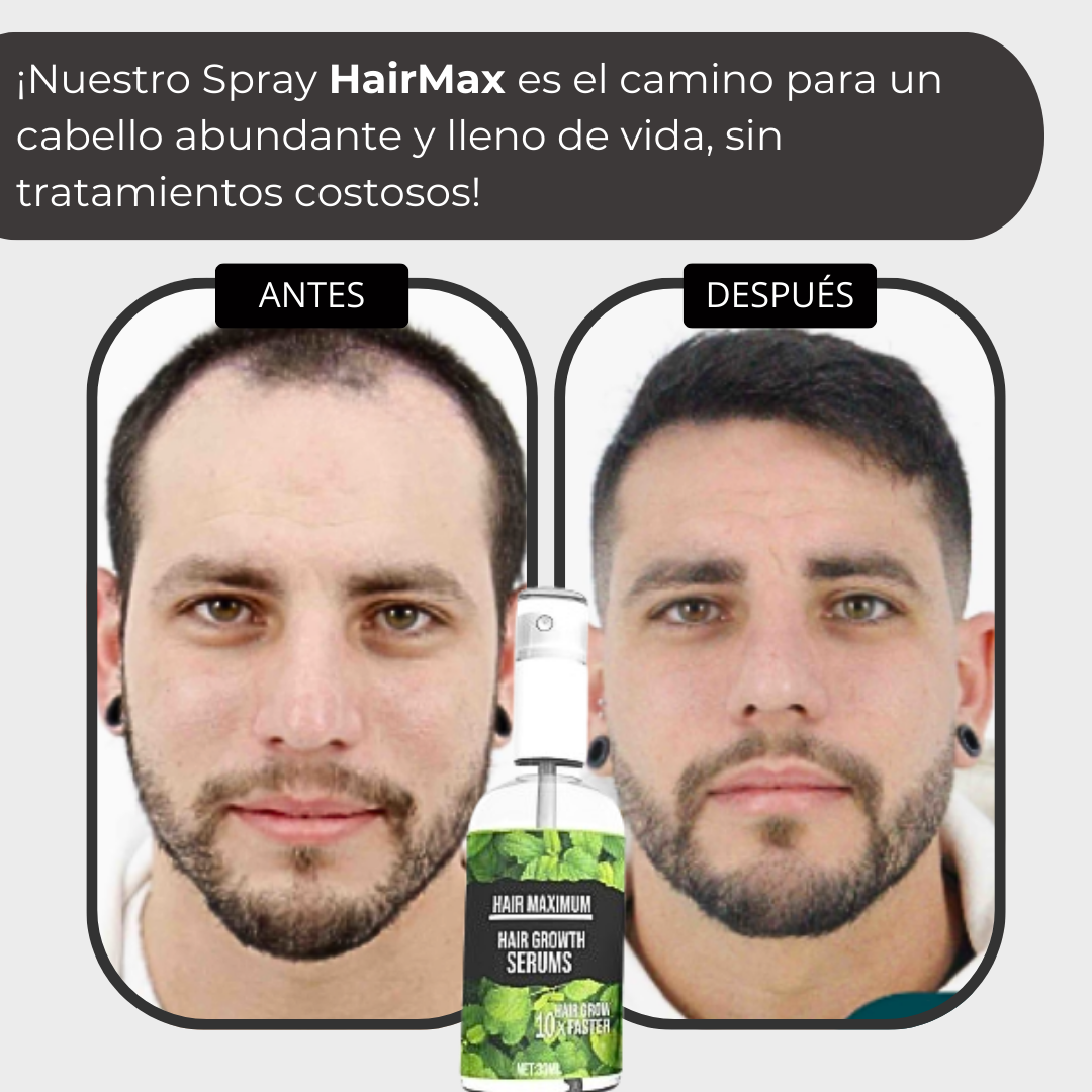 HairMax - Crece tu cabello