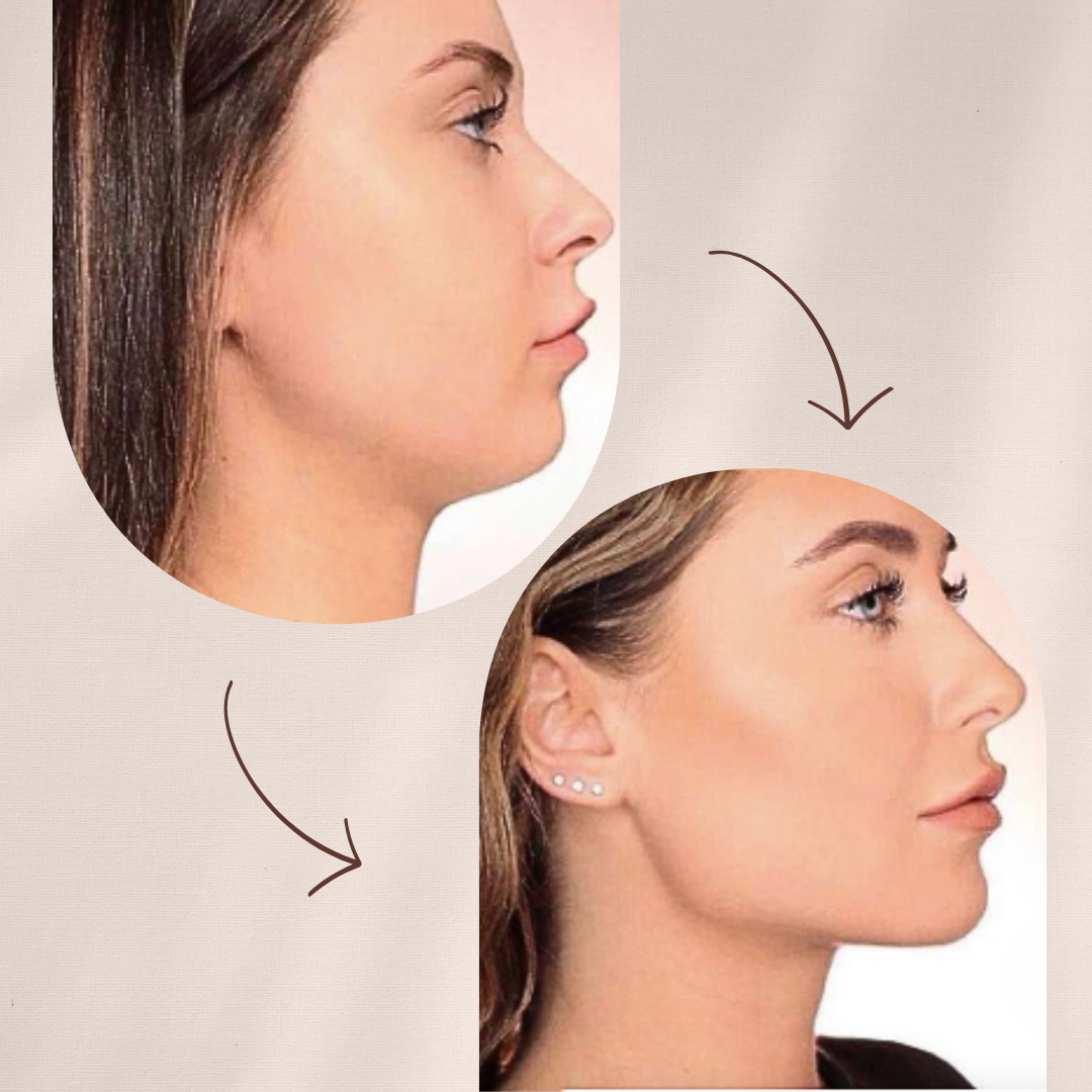 GlowX - Tonifica tu rostro