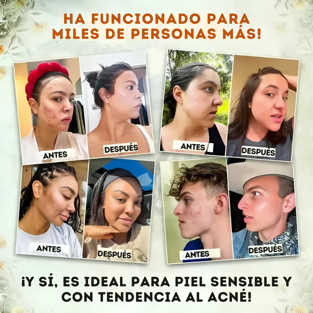 FACIAL TALLOW® (3 PIEZAS) ✨ Bálsamo Anti-Envejecimiento