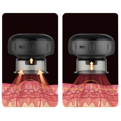 VentPro™ Masajeador Eléctrico Con Terapia De Luz Roja