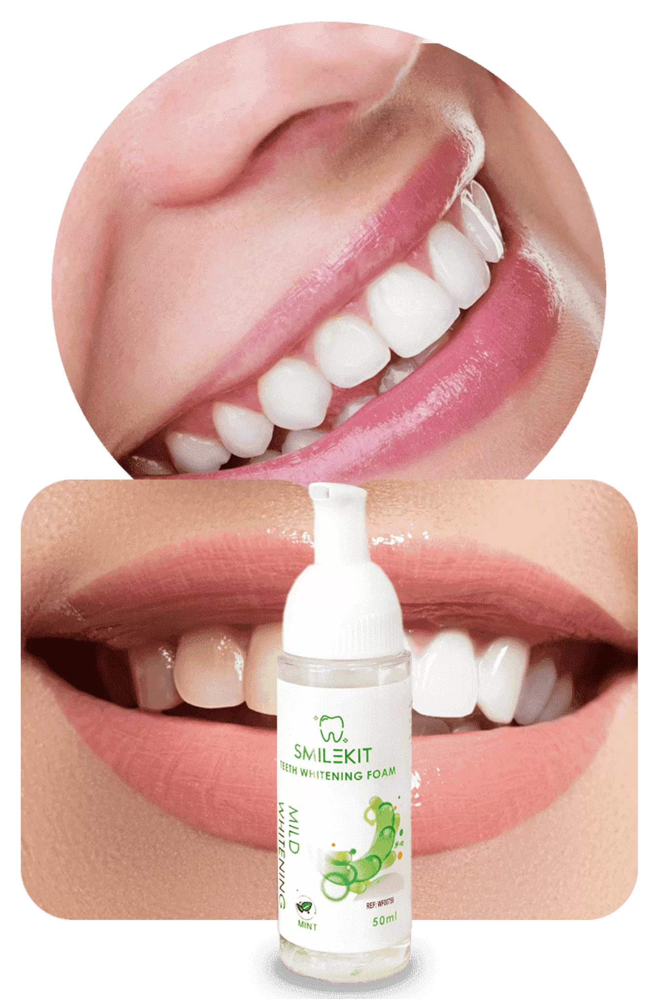 SMILEKIT - ESPUMA BLANQUEADORA