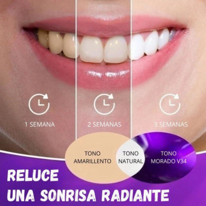 LumiDent® - Transforma tu sonrisa